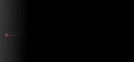 &nbsp; &nbsp; 第一次做心电图累惨我了,死电脑你网速敢不敢再慢一点